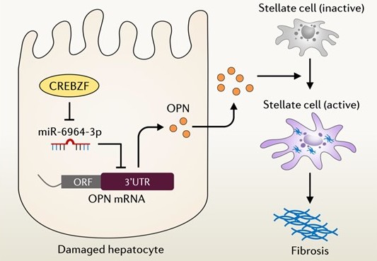 Scientists Identify Novel Mechanism of Liver Fibrosis and NASH via CREB/ATF bZIP Transcription Factor-mediated Production and Secretion of Osteopontin